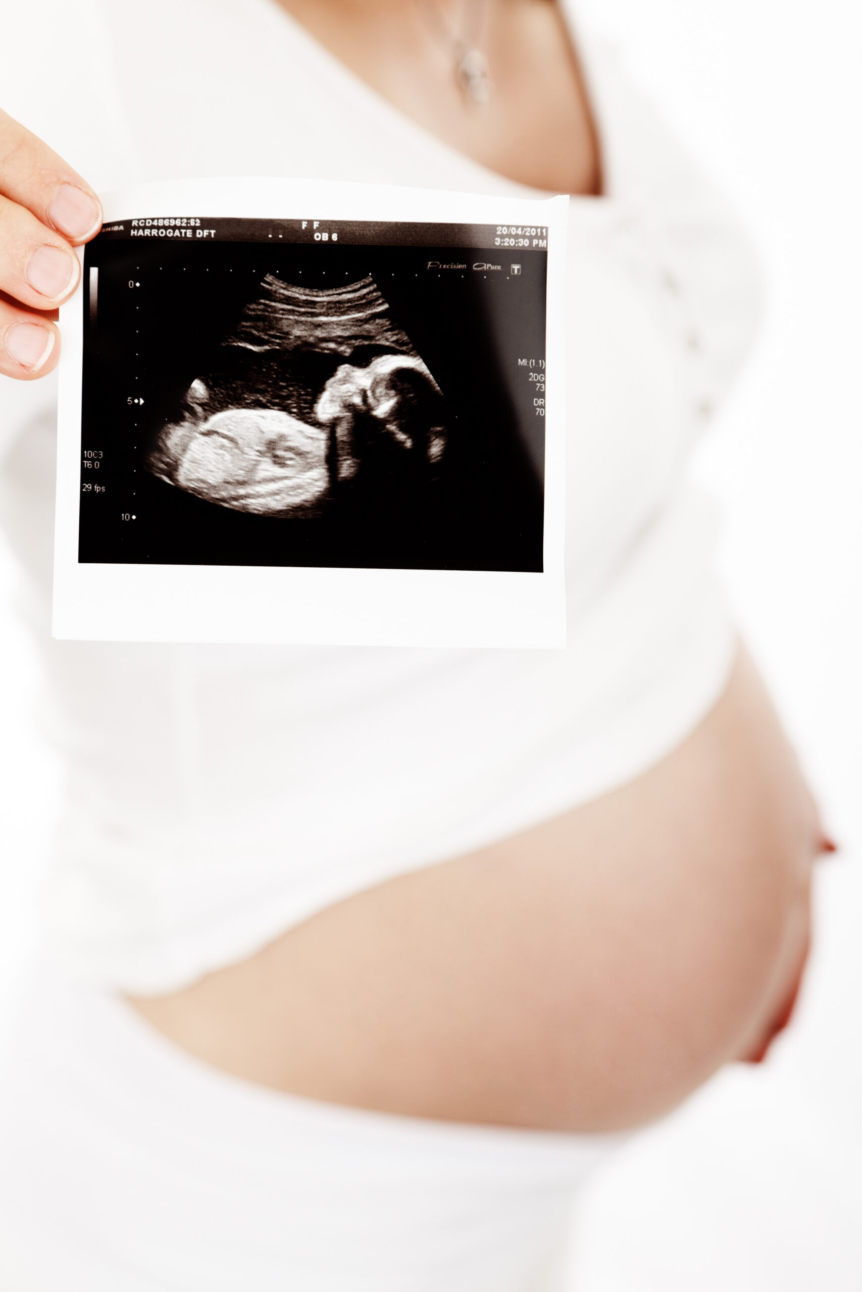 Canva – Pregnant Woman Holding Ultrasound on White Background